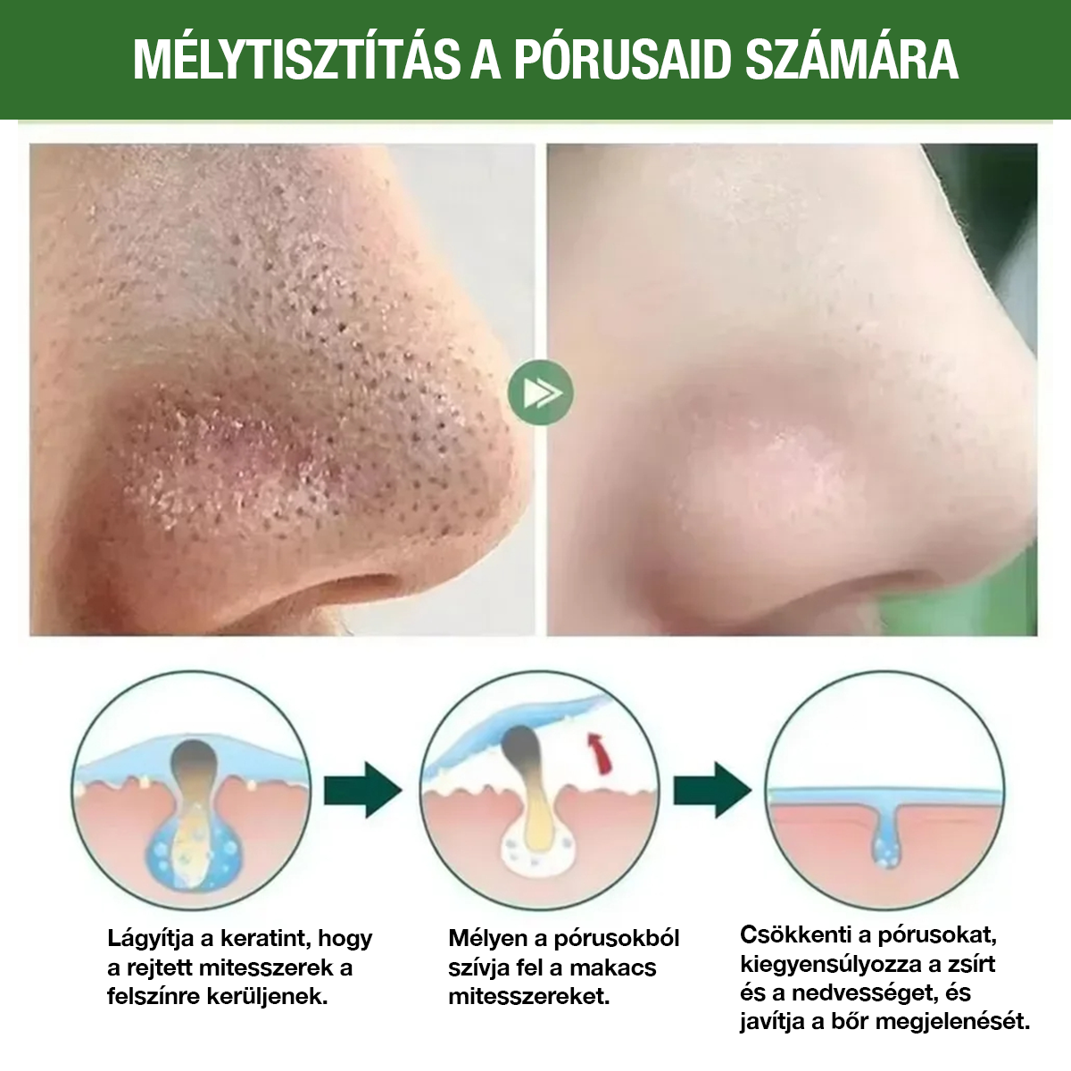 GreenMask Különleges Csomag – Vigyél 2-t 1 áráért